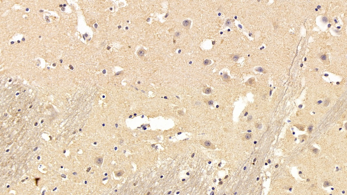 DAB staining on IHC-P; Sample: Human Testis Tissue; Primary Ab: 30ug/ml Mouse Anti-Human CCT2 Antibody; Second Ab: 2ug/mL HRP-Linked Caprine Anti-Mouse IgG Polyclonal Antibody