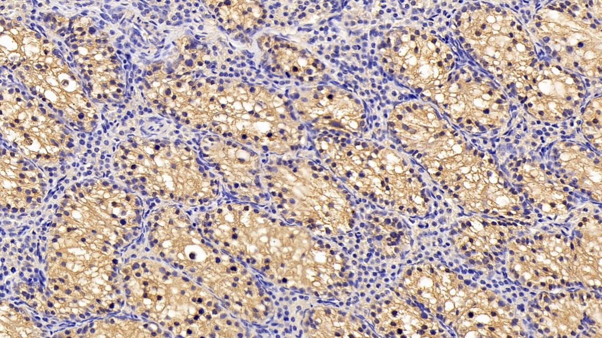 DAB staining on IHC-P; Sample: Human Kidney Tissue; Primary Ab: 30ug/ml Mouse Anti-Human CCT2 Antibody; Second Ab: 2ug/mL HRP-Linked Caprine Anti-Mouse IgG Polyclonal Antibody