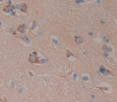 WB Image