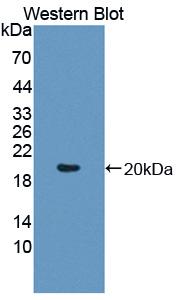 Western Blot; Sample: Lane1: Rat Cerebrum lysate; Lane2: Mouse Cerebrum lysate; Lane3: Porcine Cerebrum lysate; Primary Ab: 0.1ug/ml Rabbit Anti-Human APLP1 Antibody; Second Ab: 0.2ug/mL HRP-Linked Caprine Anti-Rabbit IgG Polyclonal Antibody