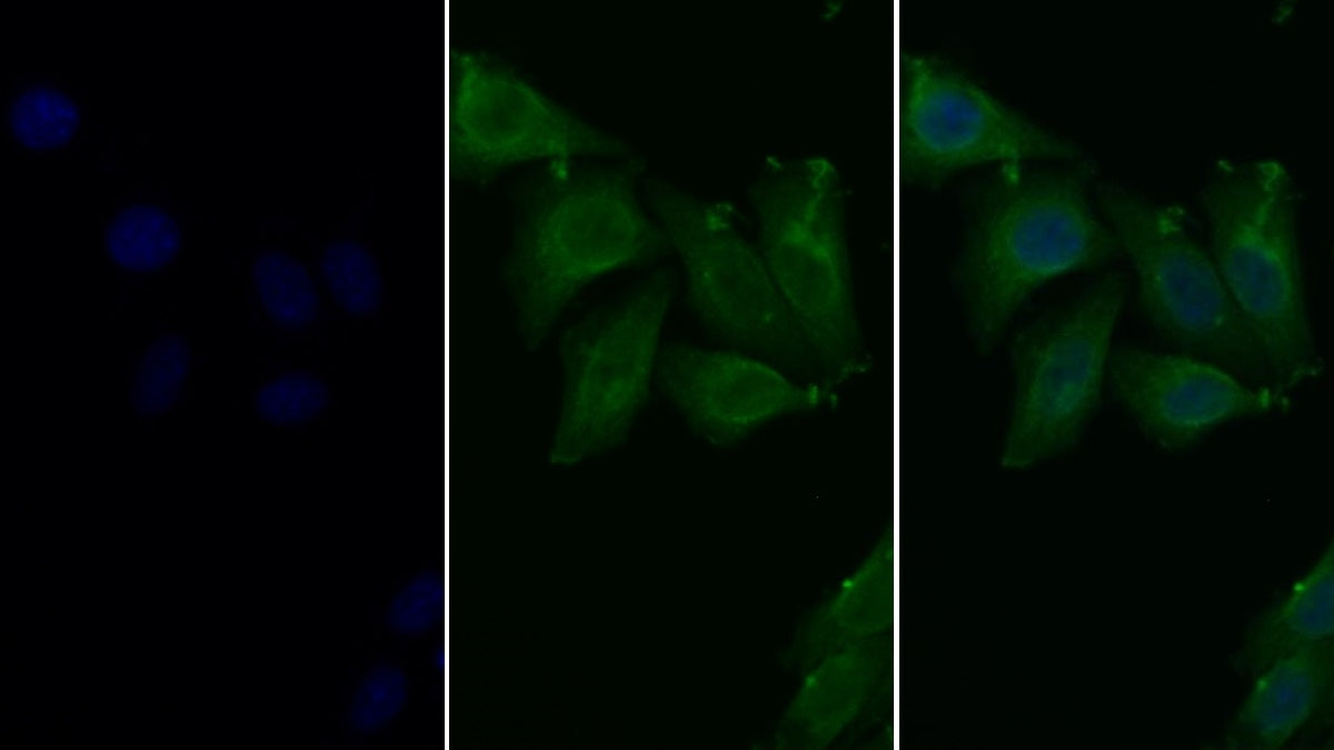 Albumin (ALB) Monoclonal Antibody - image 2