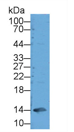 Glycated Hemoglobin A1c (HbA1c) Polyclonal Antibody - image 2