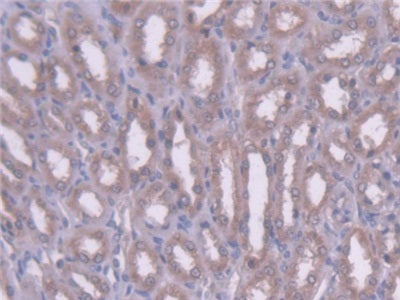 DAB staining on IHC-P; Samples: Rat Liver Tissue; Primary Ab: 20ug/ml Mouse Anti-Multi-species AngIII Antibody; Second Ab: 2ug/mL HRP-Linked Caprine Anti-Mouse IgG Polyclonal Antibody