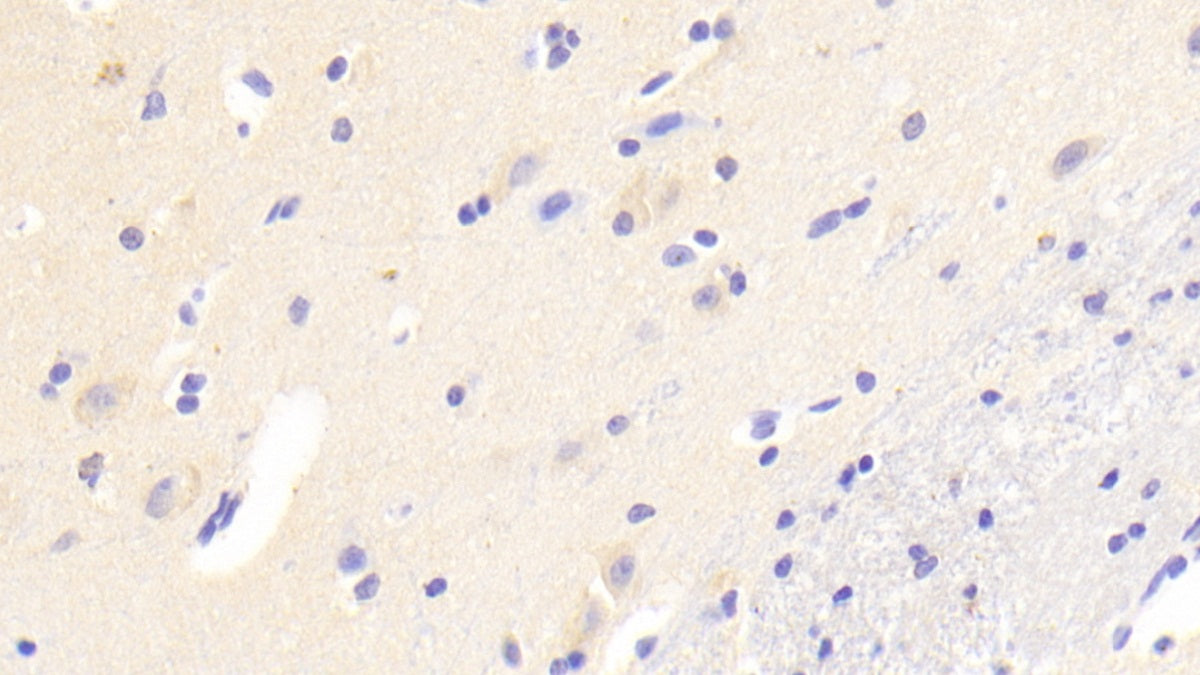 Androgen Induced Protein 1 (AIG1) Polyclonal Antibody - image 2