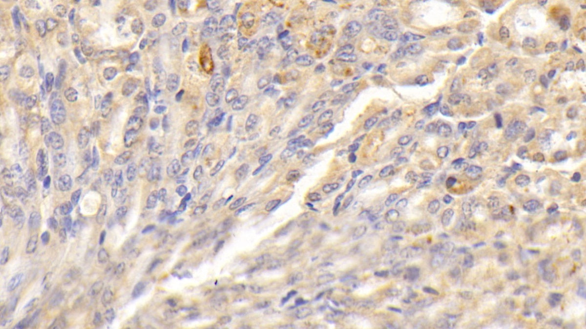 DAB staining on IHC-P; Sample: Mouse Liver Tissue; Primary Ab: 30ug/ml Rabbit Anti-Mouse a2M Antibody; Second Ab: 2ug/mL HRP-Linked Caprine Anti-Rabbit IgG Polyclonal Antibody