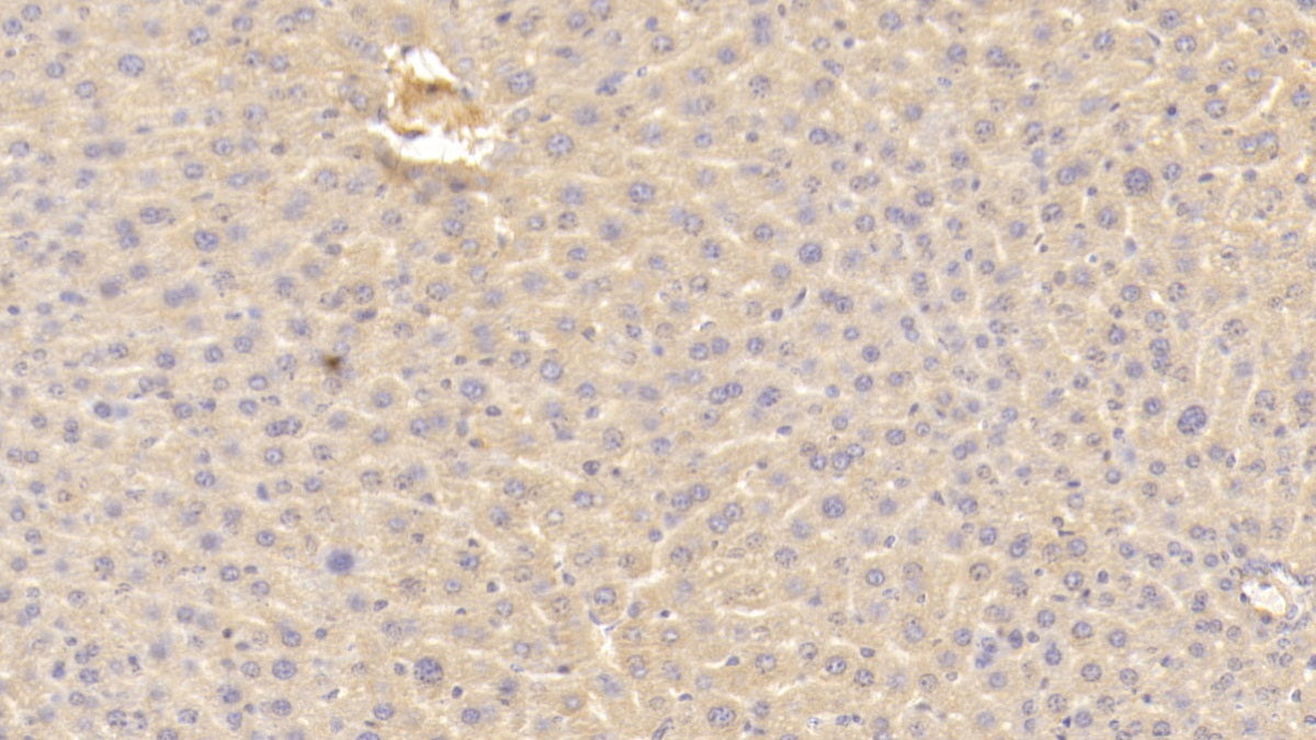 DAB staining on IHC-P; Sample: Mouse Liver Tissue; Primary Ab: 20ug/ml Rabbit Anti-Mouse PZP Antibody; Control: Used PBS instead of primary antibody; Second Ab: 2ug/ml HRP-Linked Caprine Anti-Rabbit IgG Polyclonal Antibody