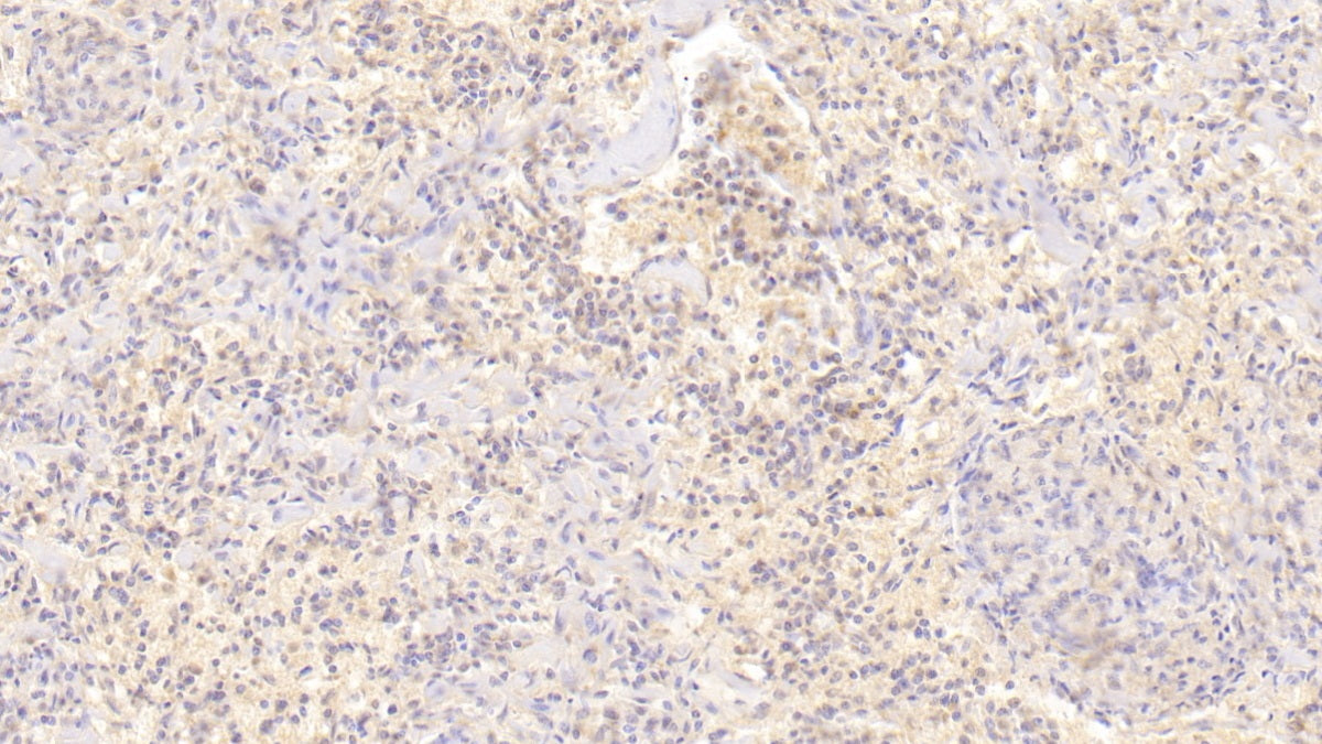 DAB staining on IHC-P; Sample: Human Kidney Tissue; Primary Ab: 30ug/ml Mouse Anti-Human DAF Antibody; Second Ab: 2ug/mL HRP-Linked Caprine Anti-Mouse IgG Polyclonal Antibody