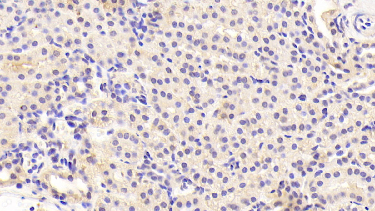 Western Blot; Sample: Lane1: Mouse Liver lysate; Lane1: Mouse Cerebellum lysate Primary Ab: 2ug/ml Rabbit Anti-Multi-species PTHrP Antibody Second Ab: 0.2ug/mL HRP-Linked Caprine Anti-Rabbit IgG Polyclonal Antibody