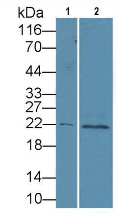Parathyroid Hormone Related Protein (PTHrP) Polyclonal Antibody - image 3