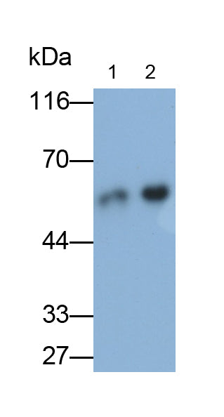 Cytokeratin 8 (CK8) Polyclonal Antibody - image 2