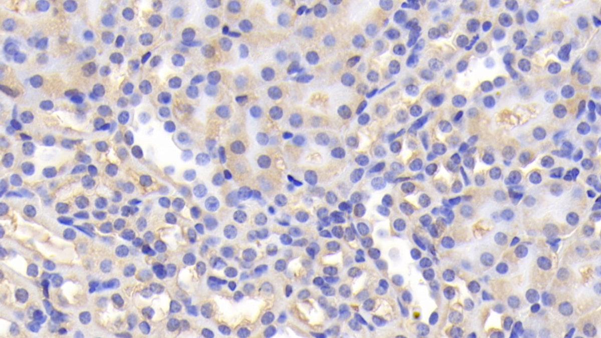 DAB staining on IHC-P; Samples: Mouse Stomach Tissue; Primary Ab: 20ug/ml Rabbit Anti-Mouse a2M Antibody; Second Ab: 2ug/mL HRP-Linked Caprine Anti-Rabbit IgG Polyclonal Antibody