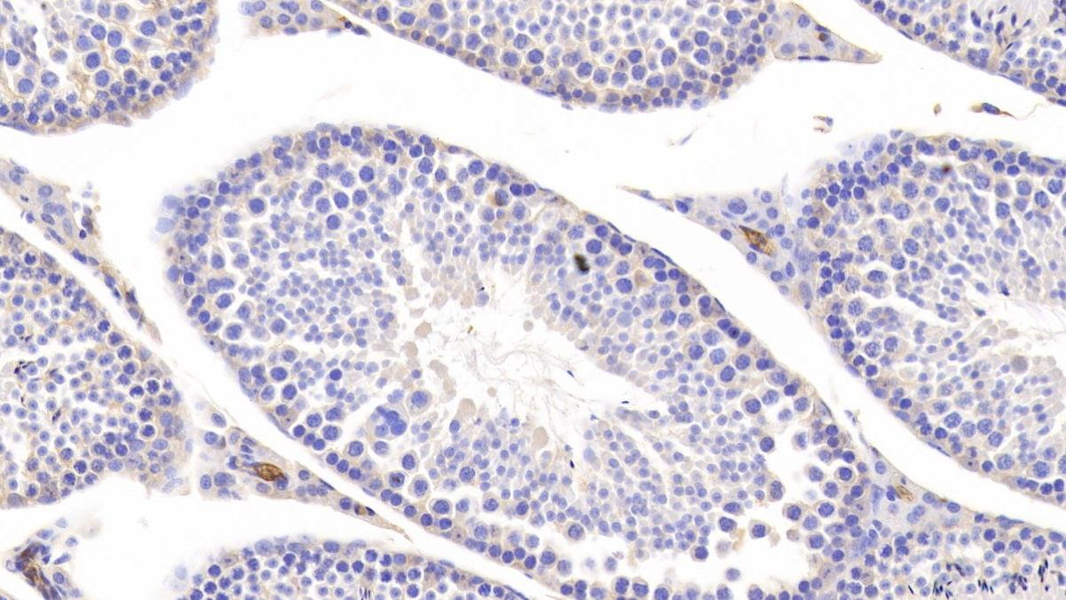 DAB staining on IHC-P; Samples: Mouse Liver Tissue; Primary Ab: 20ug/ml Rabbit Anti-Mouse a2M Antibody; Second Ab: 2ug/mL HRP-Linked Caprine Anti-Rabbit IgG Polyclonal Antibody