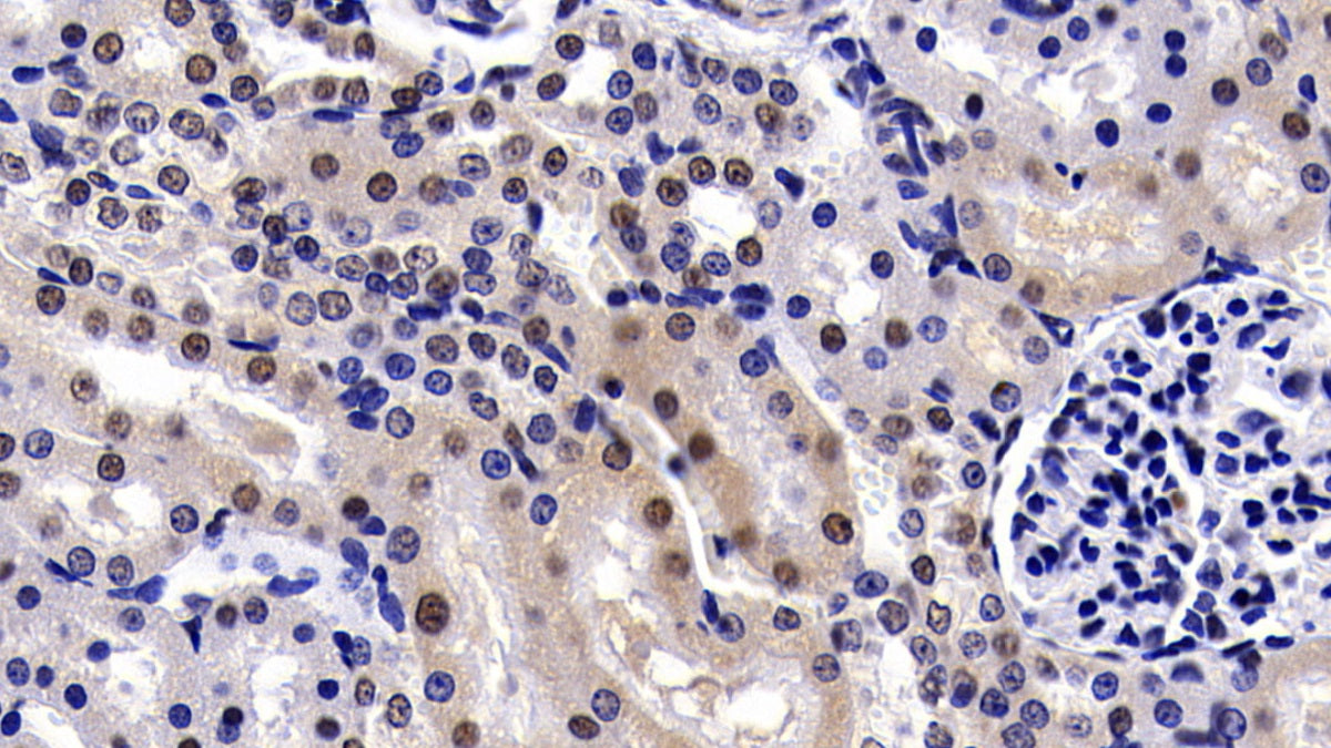 DAB staining on IHC-P; Sample: Rat Cerebrum Tissue; Primary Ab: 20ug/ml Rabbit Anti-Human PARK2 Antibody; Second Ab: 2ug/mL HRP-Linked Caprine Anti-Rabbit IgG Polyclonal Antibody