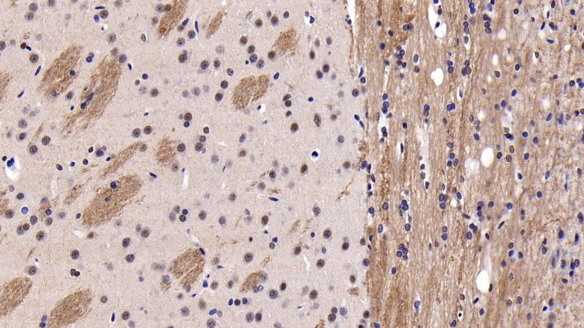 DAB staining on IHC-P; Sample: Rat Testis Tissue; Primary Ab: 20ug/ml Rabbit Anti-Human PARK2 Antibody; Second Ab: 2ug/mL HRP-Linked Caprine Anti-Rabbit IgG Polyclonal Antibody