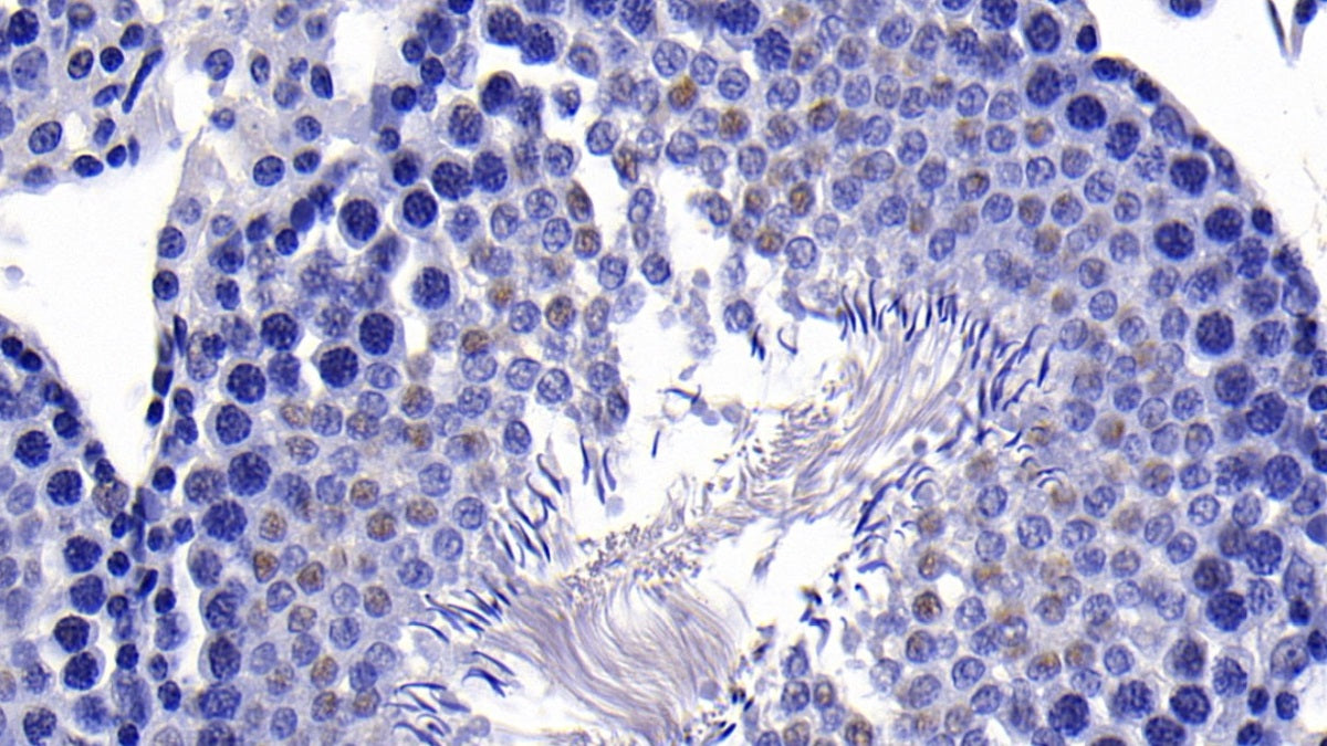 FITC staining on IF; Sample: Human U2OS cell; Primary Ab: 20ug/ml Rabbit Anti-Human PARK2 Antibody; Second Ab: 2ug/ml FITC-Linked Caprine Anti-Rabbit IgG Polyclonal Antibody