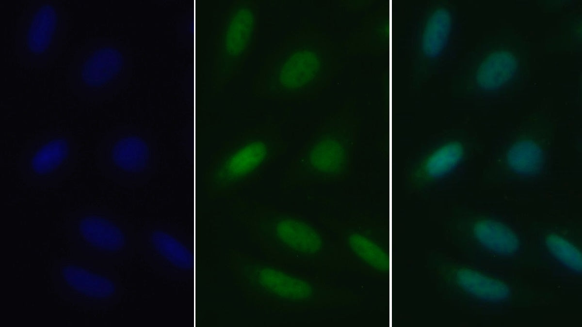 Parkinson Disease Protein 2 (PARK2) Polyclonal Antibody - image 5