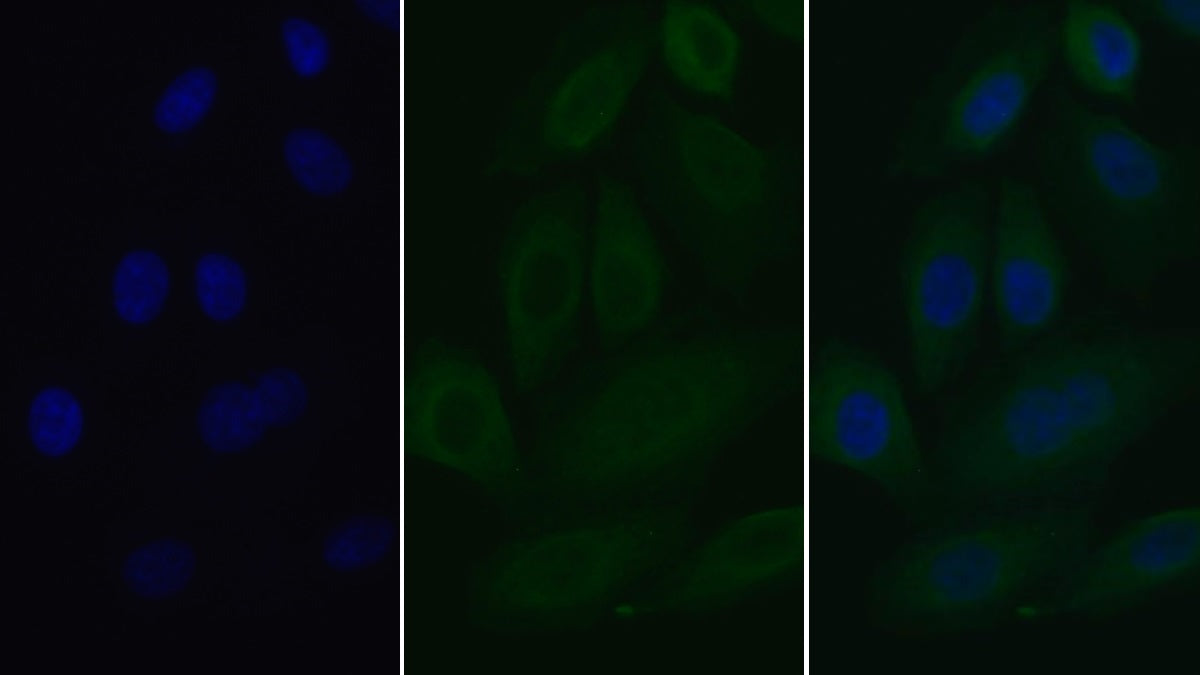Interleukin 2 Receptor Alpha (IL2Ra) Monoclonal Antibody - image 2
