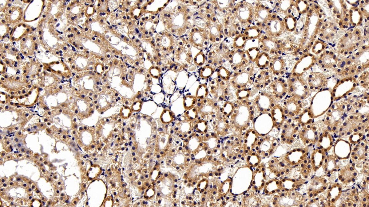 DAB staining on IHC-P; Sample: Rat Cerebrum Tissue; Primary Ab: 20ug/ml Mouse Anti-Multi-species STAT3 Antibody; Second Ab: 2ug/mL HRP-Linked Caprine Anti-Mouse IgG Polyclonal Antibody