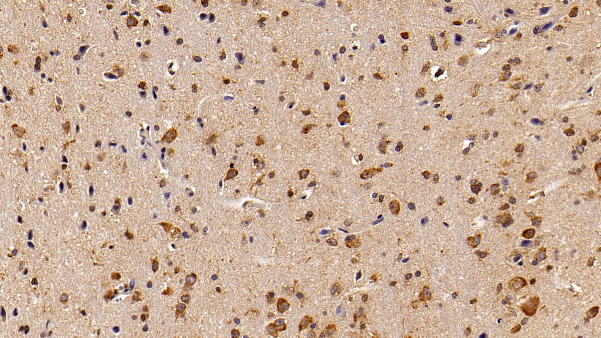 DAB staining on IHC-P; Sample: Rat Pancreas Tissue; Primary Ab: 20ug/ml Mouse Anti-Multi-species STAT3 Antibody; Second Ab: 2ug/mL HRP-Linked Caprine Anti-Mouse IgG Polyclonal Antibody