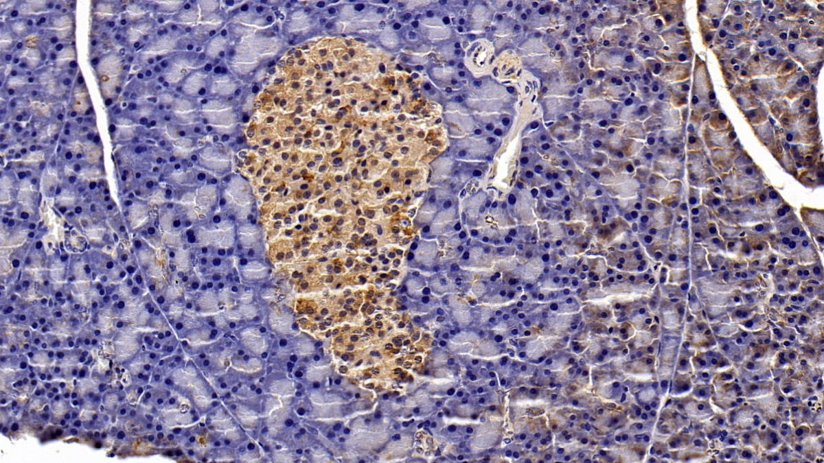 Signal Transducer And Activator Of Transcription 3 (STAT3) Monoclonal Antibody - image 5