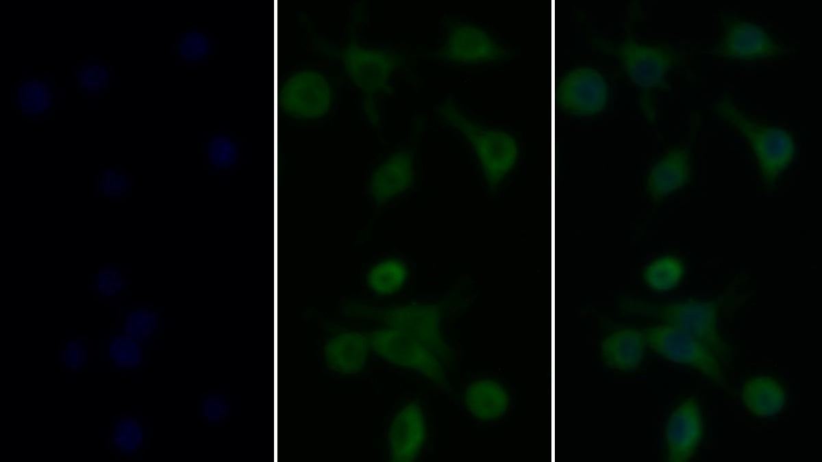 Tumor Necrosis Factor Alpha (TNFa) Monoclonal Antibody - image 2