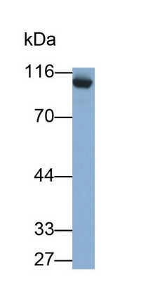 Angiotensin I Converting Enzyme 2 (ACE2) Monoclonal Antibody - image 2