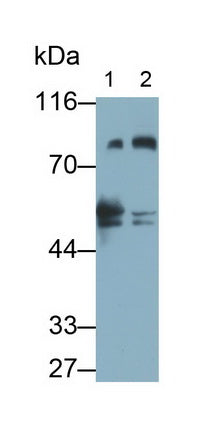 Protein Kinase C Epsilon (PKCe) Monoclonal Antibody - image 2