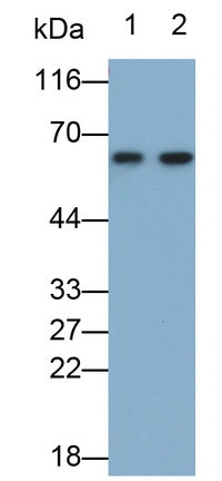 Alpha-1-Antitrypsin (a1AT) Monoclonal Antibody - image 2