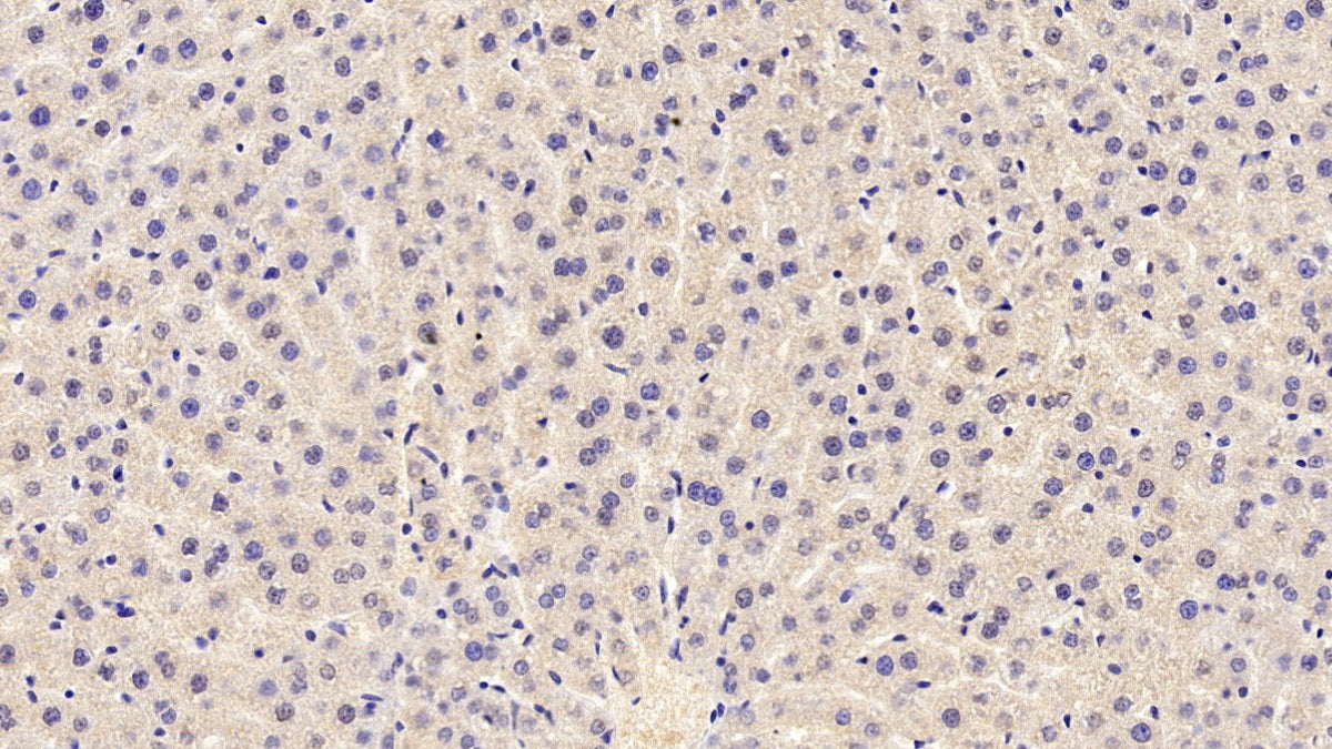 DAB staining on IHC-P; Sample: Rat Kidney Tissue; Primary Ab: 20ug/ml Mouse Anti-Rat TRPM4 Antibody; Second Ab: 2ug/mL HRP-Linked Caprine Anti-Mouse IgG Polyclonal Antibody