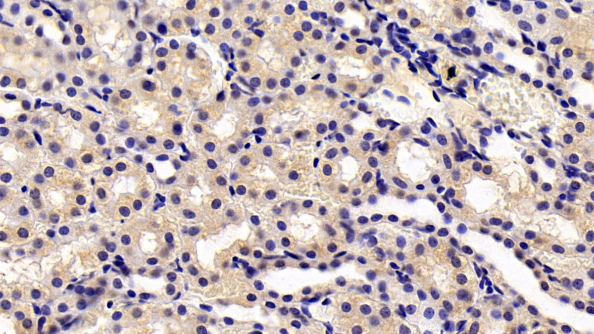 Transient Receptor Potential Cation Channel Subfamily M, Member 4 (TRPM4) Monoclonal Antibody - image 3