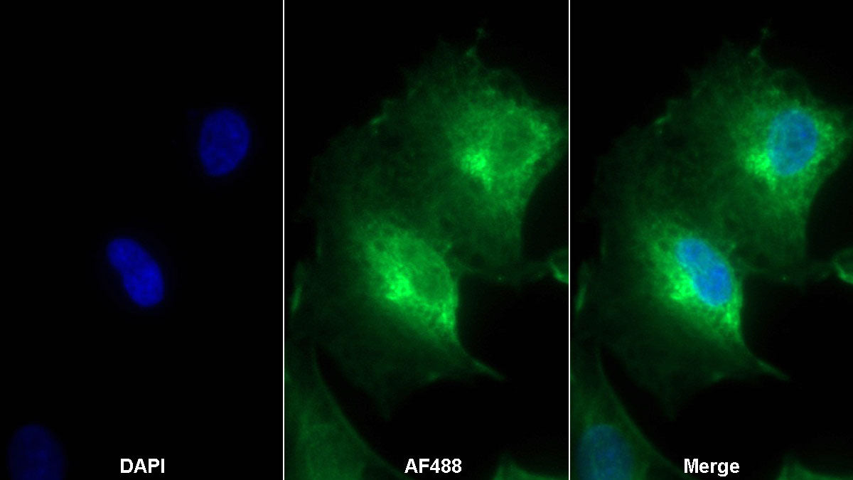 Western Blot; Sample: Rat Plasma Primary Ab: 2ug/ml Mouse Anti-Rat LCN2 Antibody Second Ab: 0.2ug/ml HRP-Linked Caprine Anti-Mouse IgG Polyclonal Antibody
