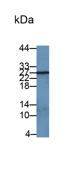 Western Blot; Samples: Lane1: Rat Spleen lysate; Lane2: Rat Lung lysate; Primary Ab: 0.4ug/ml Mouse Anti-Rat LCN2 Antibody; Second Ab: 0.2ug/ml HRP-Linked Caprine Anti-Mouse IgG Polyclonal Antibody