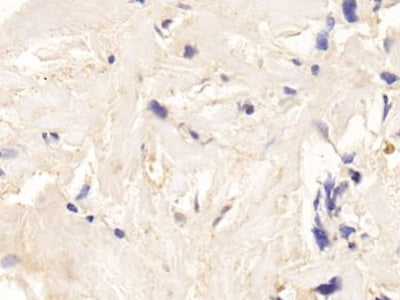 Adrenocorticotropic Hormone (ACTH) Polyclonal Antibody - image 3