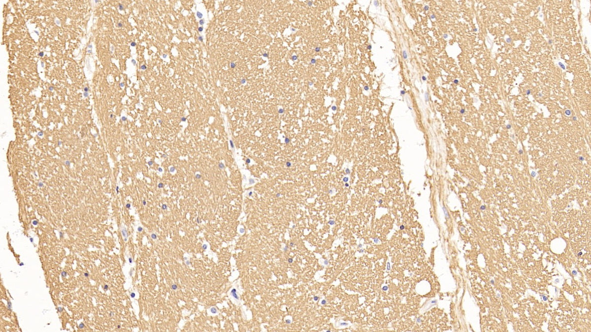 Western Blot; Sample: Lane1: Porcine Cerebrum lysate; Lane1: Rat Cerebrum lysate; Lane1: Mouse Cerebrum lysate Primary Ab: 0.005ug/ml Rabbit Anti-Multi-species MBP Antibody Second Ab: 0.2ug/mL HRP-Linked Caprine Anti-Rabbit IgG Polyclonal Antibody