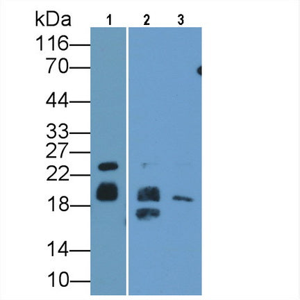 Myelin Basic Protein (MBP) Polyclonal Antibody - image 3