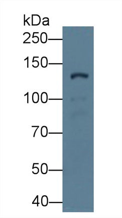 Procollagen III N-Terminal Propeptide (PIIINP) Monoclonal Antibody - image 2