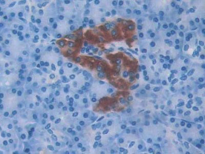 Amylin (Amylin) Monoclonal Antibody - image 2
