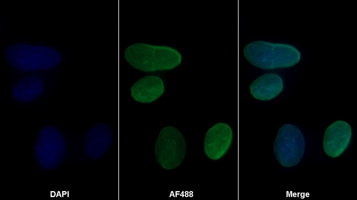 Western Blot; Samples: Lane1: MCF7 cell lysate; Lane2: PC3 cell lysate; Primary Ab: 0.01ug/ml Mouse Anti-Human ERb Antibody; Second Ab: 0.2ug/ml HRP-Linked Caprine Anti-Mouse IgG Polyclonal Antibody