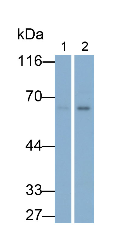 Estrogen Receptor Beta (ERb) Monoclonal Antibody - image 3