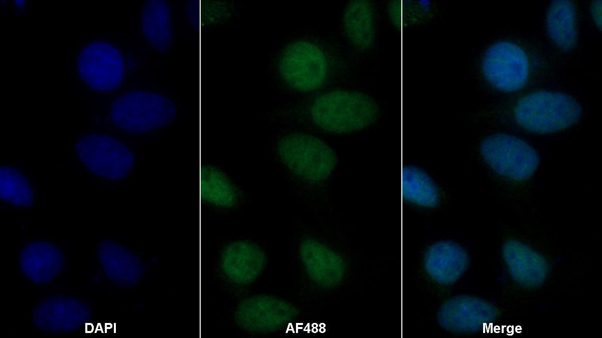 Complement Component 1, R Subcomponent (C1r) Polyclonal Antibody - image 2