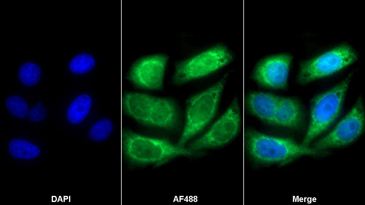 Fibronectin Leucine Rich Transmembrane Protein 3 (FLRT3) Monoclonal Antibody - image 2