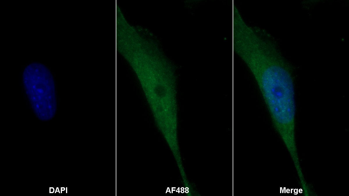 S100 Calcium Binding Protein A11 (S100A11) Monoclonal Antibody - image 2