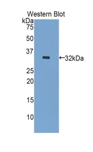 Insulin Like Growth Factor Binding Protein 1 (IGFBP1) Polyclonal Antibody - image 2