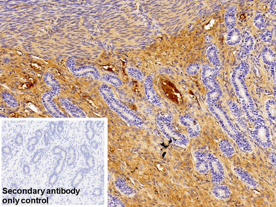 DAB staining on IHC-P; Sample: Porcine Small intestine Tissue; Primary Ab: 10ug/ml Rabbit Anti-Human AT Antibody; Control: Used PBS instead of primary antibody; Second Ab: 2ug/ml HRP-Linked Caprine Anti-Rabbit IgG Polyclonal Antibody