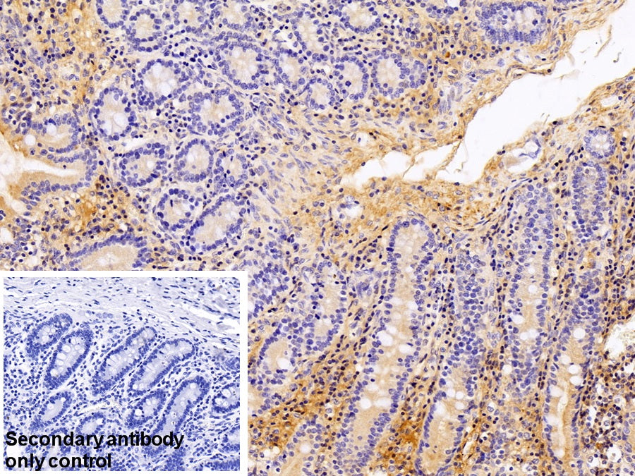 DAB staining on IHC-P; Sample: Porcine Liver Tissue; Primary Ab: 10ug/ml Rabbit Anti-Human AT Antibody; Control: Used PBS instead of primary antibody; Second Ab: 2ug/ml HRP-Linked Caprine Anti-Rabbit IgG Polyclonal Antibody