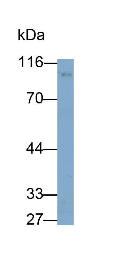 Ectonucleotide Pyrophosphatase/Phosphodiesterase 2 (ENPP2) Monoclonal Antibody - image 2