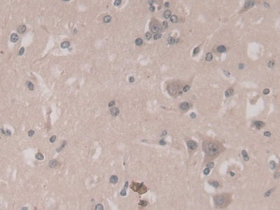 AF488 staining on IF; Sample: HepG2 cell; Primary Ab: 20ug/ml Mouse Anti-Human TGFb3 Antibody; Second Ab: 2ug/ml AF488-Linked Caprine Anti-Mouse IgG Polyclonal Antibody