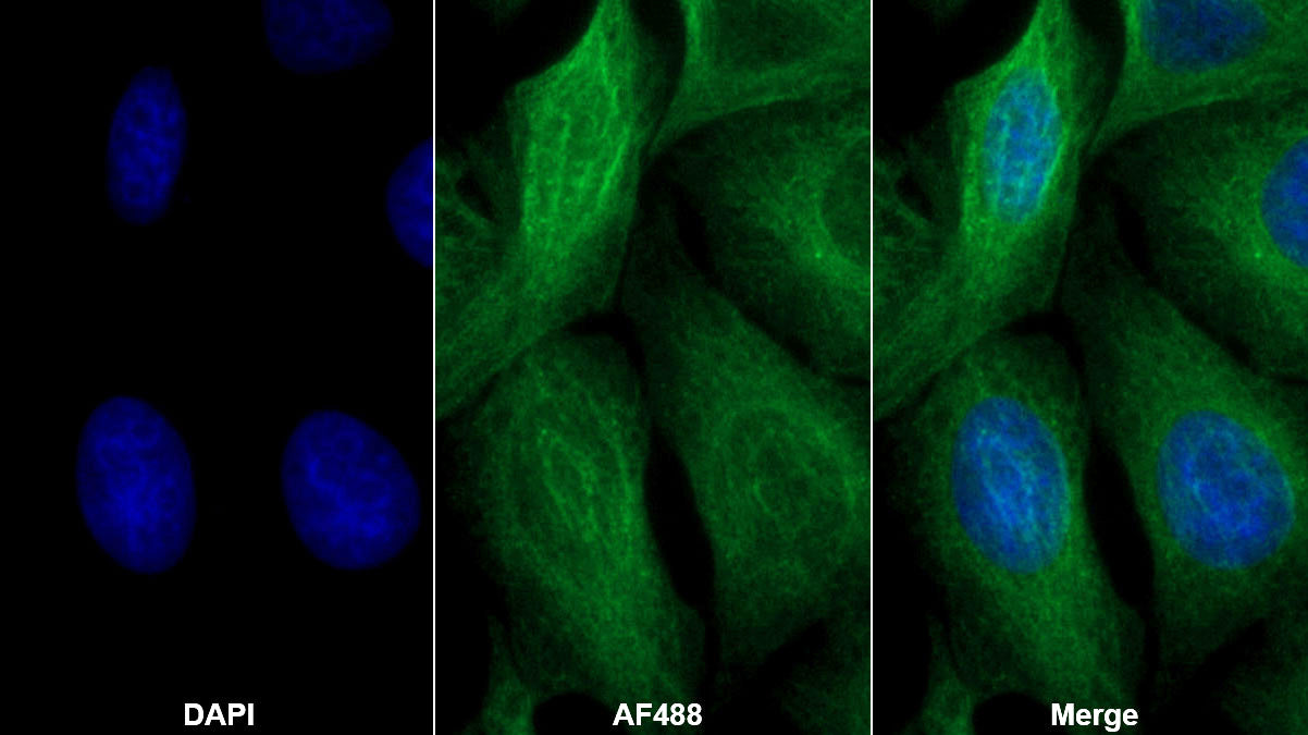 Western Blot; Sample: Human Serum Primary Ab: 3ug/ml Mouse Anti-Human TGFb3 Antibody Second Ab: 0.2ug/mL HRP-Linked Caprine Anti-Mouse IgG Polyclonal Antibody