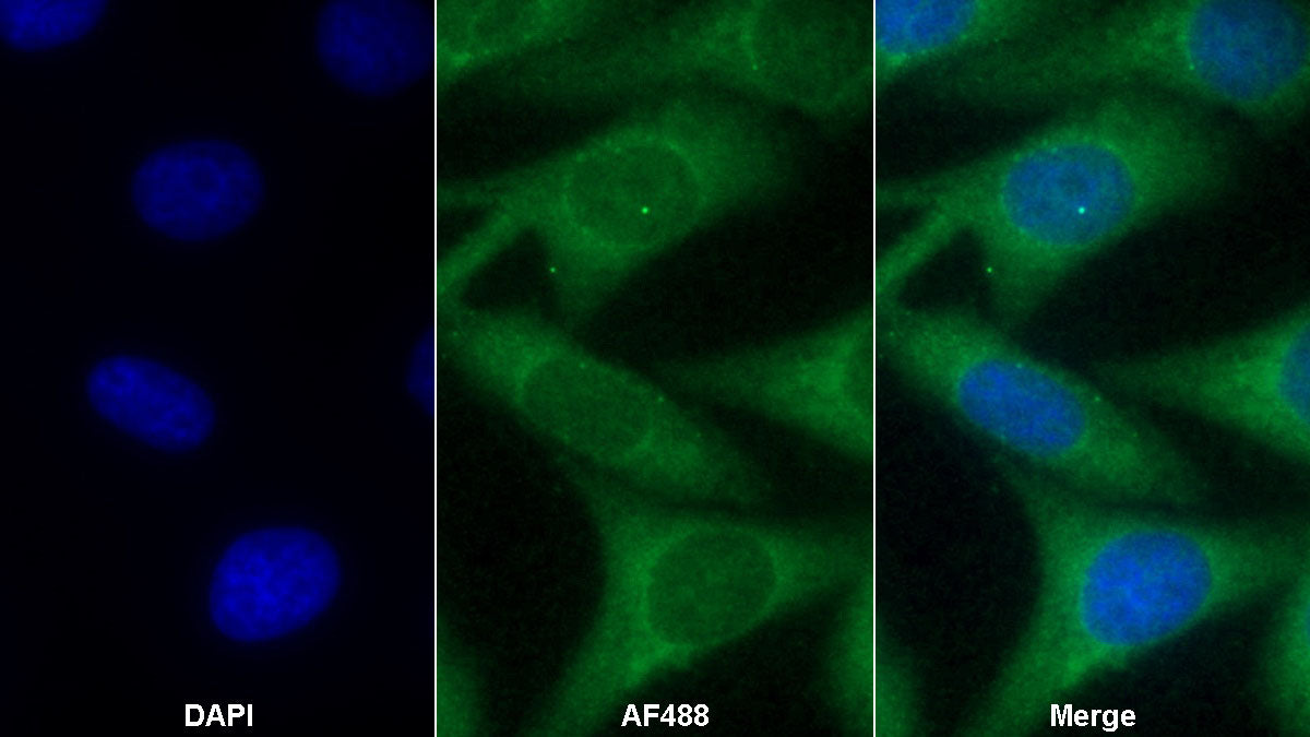 Western Blot; Sample: Lane1: Porcine Liver lysate; Lane2: Porcine Lung lysate Primary Ab: 0.2ug/ml Mouse Anti-Human IGF1 Antibody Second Ab: 0.2ug/mL HRP-Linked Caprine Anti-Mouse IgG Polyclonal Antibody