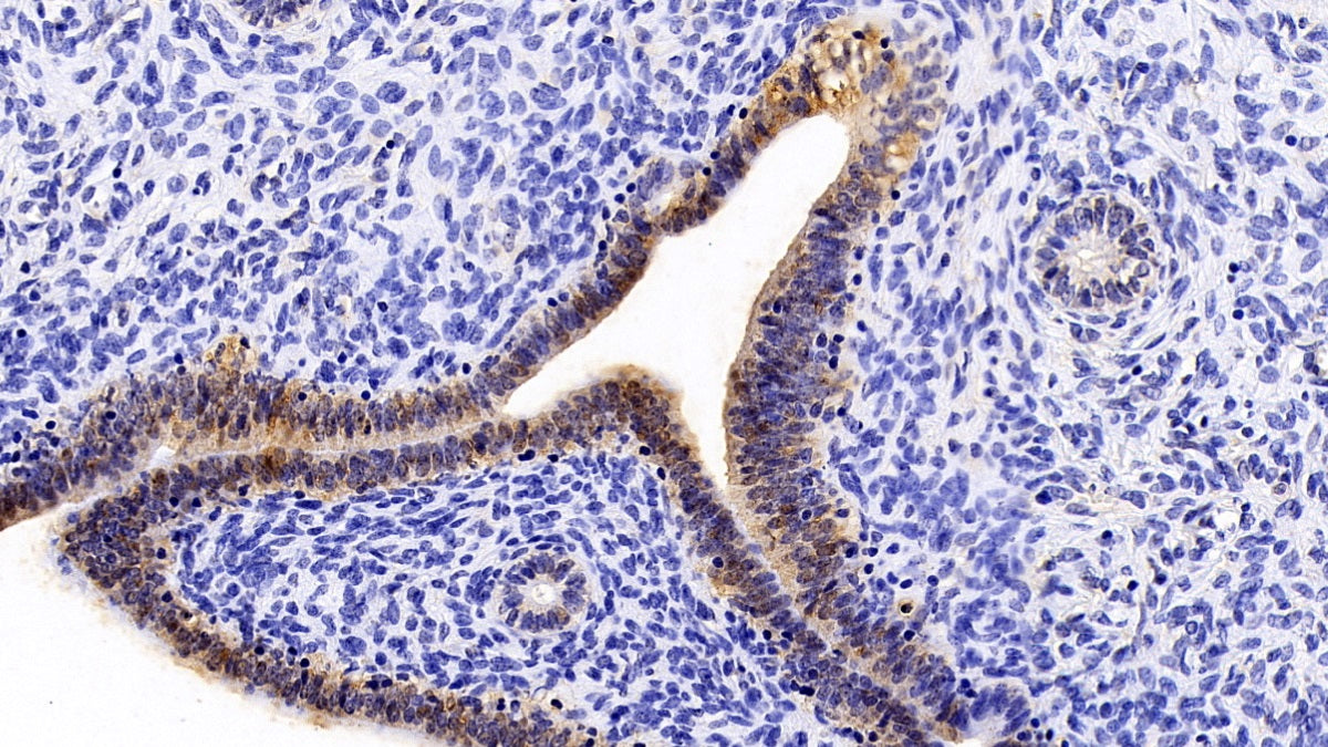 Western Blot; Sample: Lane1: Porcine Skin lysate; Lane2: Porcine Esophagus; Lane3: A431 cell lysate Primary Ab: 0.2ug/ml Mouse Anti-Human S100A2 Antibody Second Ab: 0.2ug/mL HRP-Linked Caprine Anti-Mouse IgG Polyclonal Antibody